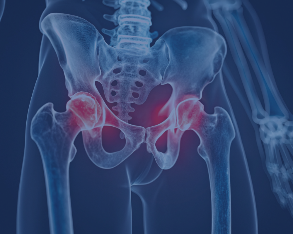 Homepage   Robotic Assisted Total Hip Replacement