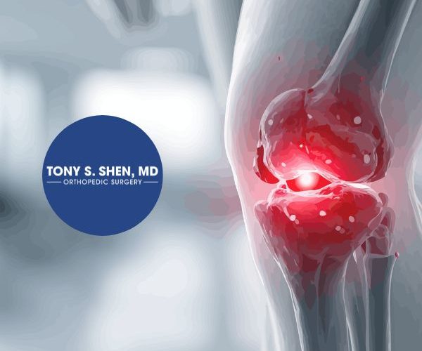 Tony Shen LP 14 600x500
